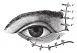 blefaroplastia